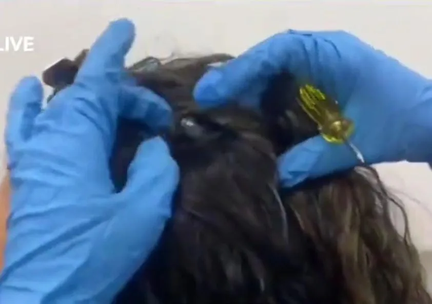 "Tenían la cabeza metida en el negocio", en Cali capturaron a mujeres que viajarían con cocaína en sus pelucas