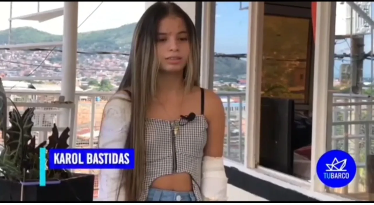Karen Yumbo prótesis