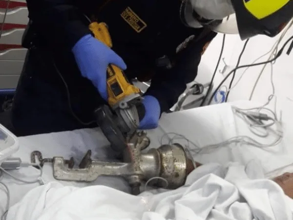 La mano del niño que quedó atrapada en el molino sufrió lesiones; en Pasto atendieron la emergencia