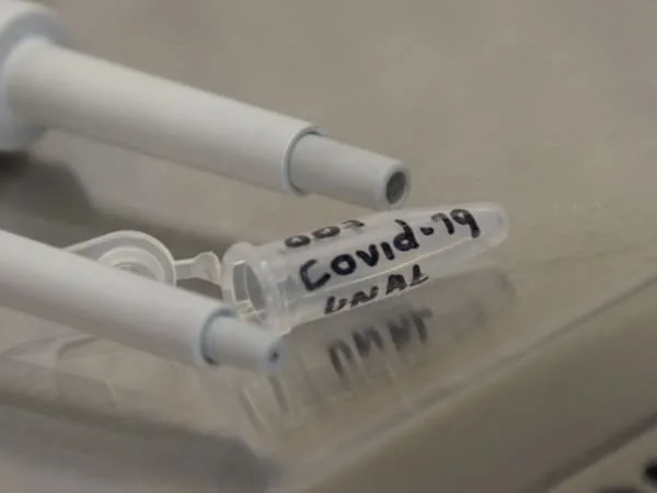 Sociedades Científicas pide actualizar vacunas COVID-19 ante nuevas variantes: Carta al MinSalud