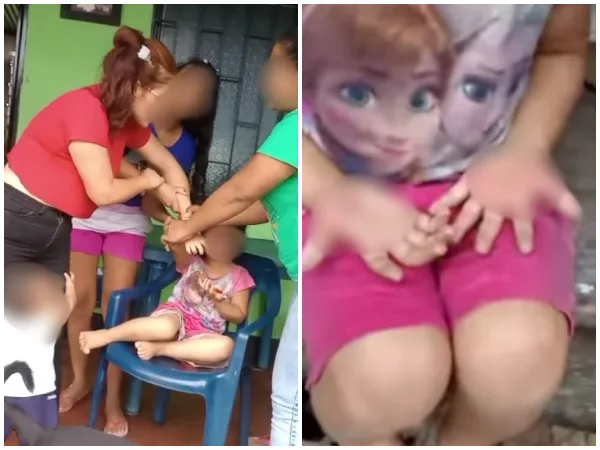 En Arauquita, Arauca, "porque robo una monedas", madre quemó las manos de su hija