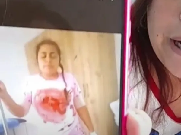 Mónica lleva meses en recuperación: el lío por "un (presunto) mal procedimiento" en una clínica estética de Popayán
