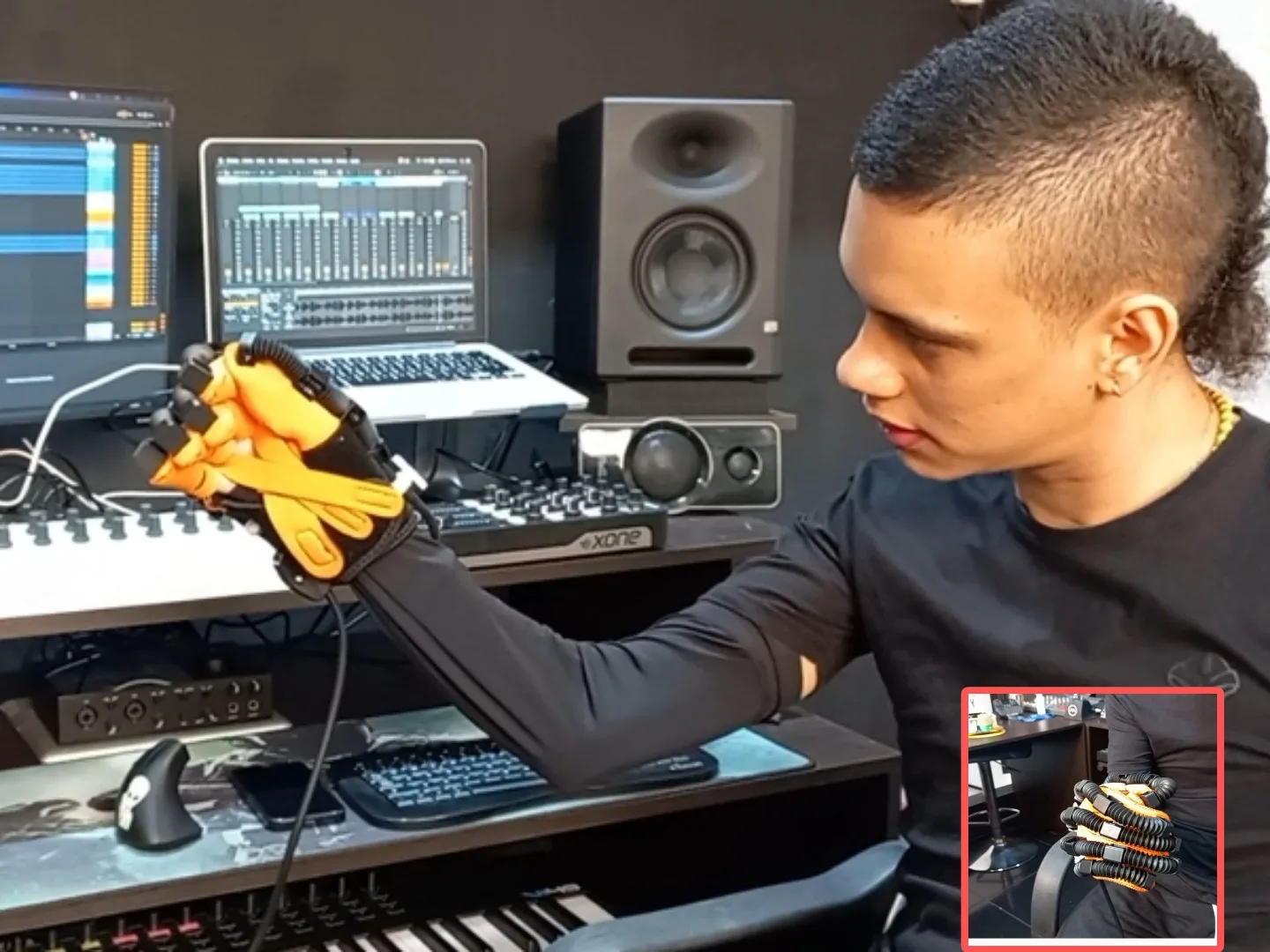 Alejo M Dj mano biónica