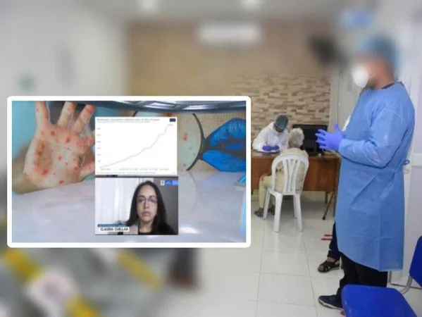 En Cartago está el primer contagiado con 'viruela del mono' del Valle, "tuvo contacto con otro caso de Pereira"