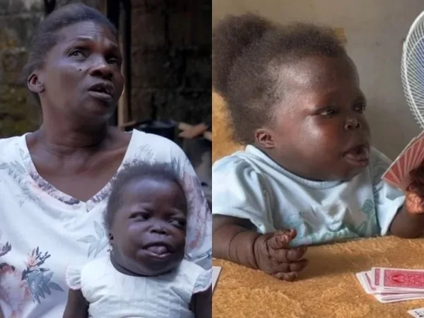 Apoyo urgente para Yorleana, el gran corazón detrás de la mujer más pequeña de Colombia
