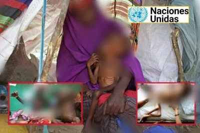 Somalia niños hambre