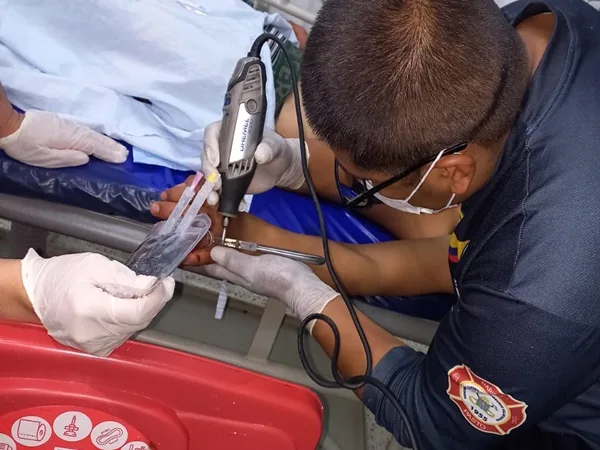 Se quemó con pólvora, se le inflamó la mano y tuvieron que llamar a los Bomberos para extraerle el anillo