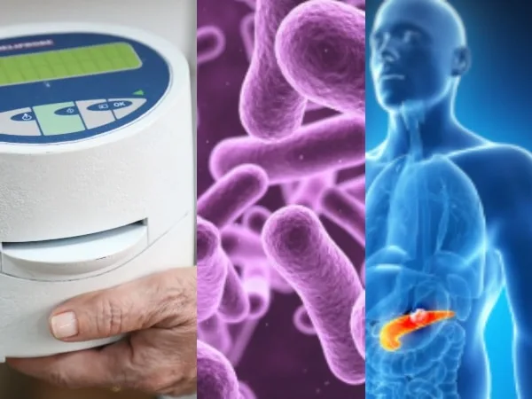 Valle del Cauca lanza jornadas gratuitas para la detección de una bacteria relacionada con cáncer gástrico