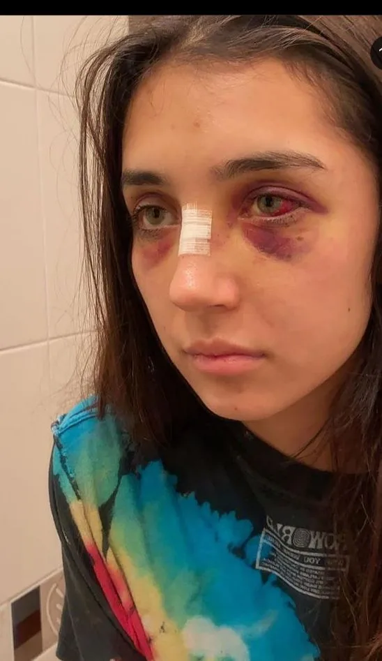 Camilla denuncia agresiones de su expareja Sebastián