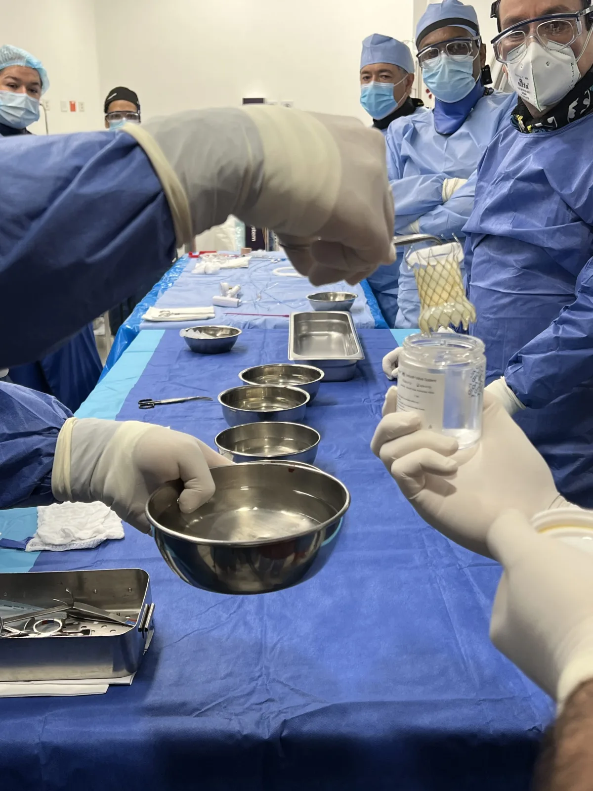 Un logro más de la Fundación Valle del Lili, primera instalación de válvula pulmonar en Colombia