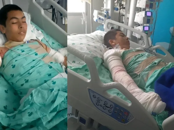 Adolescente de Yumbo perdió un brazo tras accidente con una cometa: su familia pide ayuda