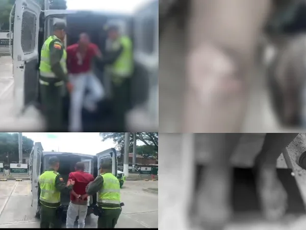 Mujer fue atacada con tinner y le produjo quemaduras, su pareja sentimental fue capturada en Palmira