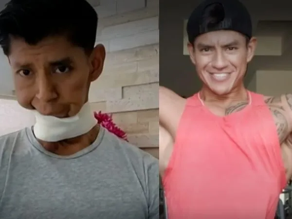 A hombre en México odontólogo le descubrió cáncer por extraña molestia en su boca: pensó que era por sus brackets