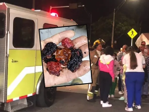 Habitantes de un barrio se intoxicaron con pimiento picante que tuvo falla en su preparación.