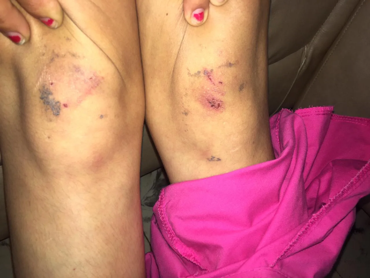 taxista caso San Marcos en Cali