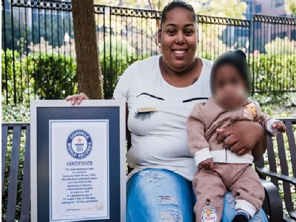 La historia de Curtis, el bebé que ostenta un Guinness Records como el más prematuro del mundo que sobrevive