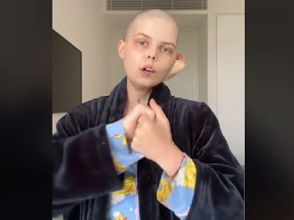 Bella Bradford, influencer que murió de un extraño cáncer.