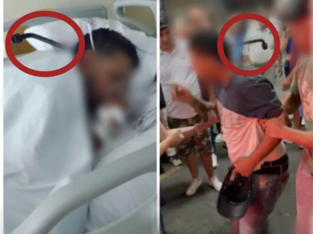 No han podido retirarle la cruceta de la cabeza al taxista herido por otro conductor, en Medellín