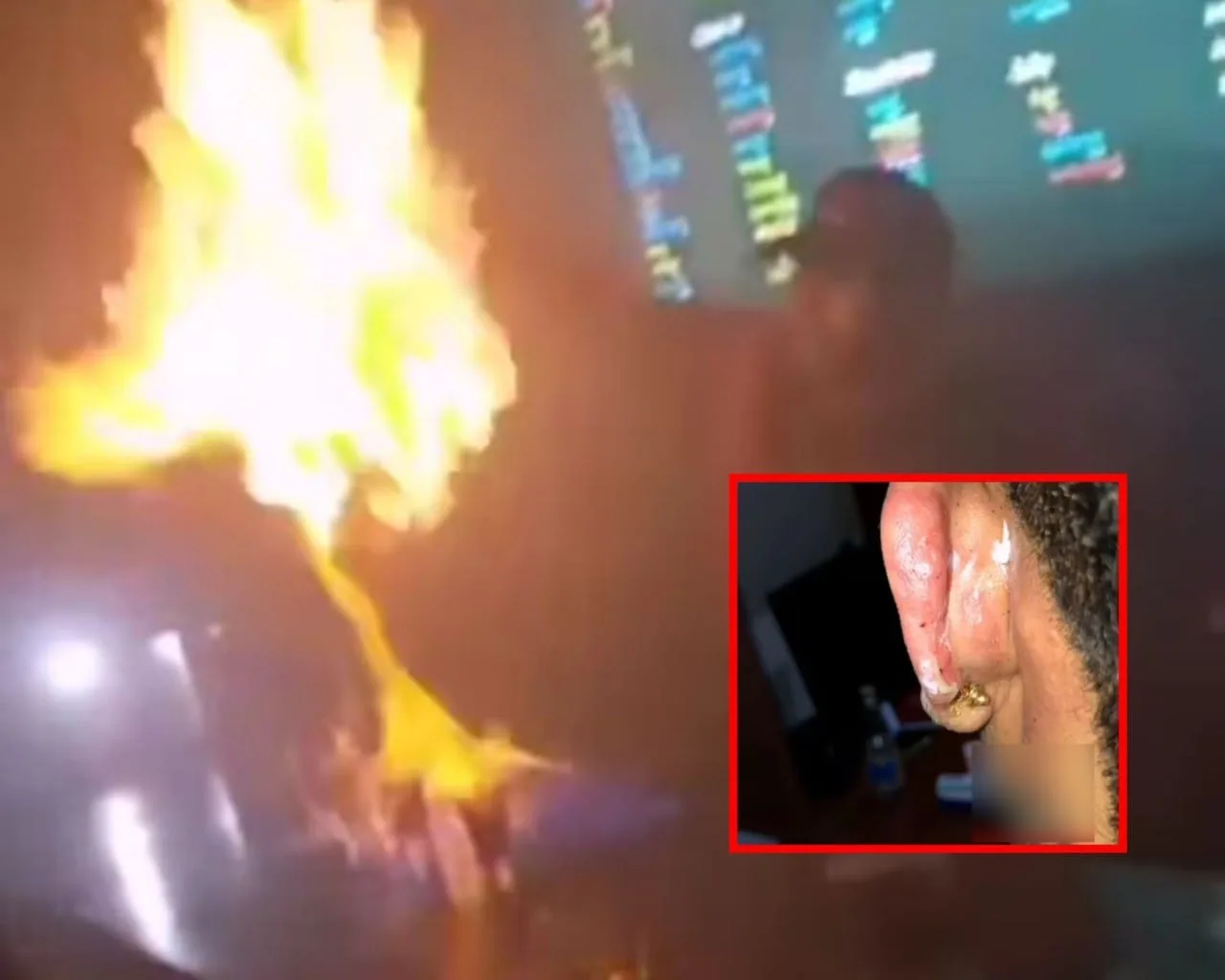Se prendió el cóctel y un joven resultó herido, en una discoteca en Cali