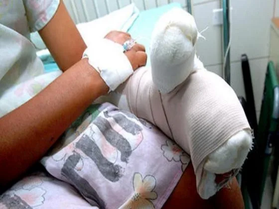No llegan las fiestas decembrinas y ya hay un quemado con pólvora, es un estudiante de 17 años