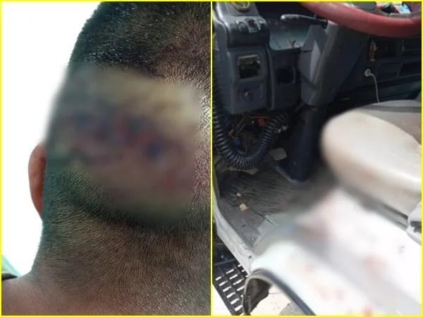 ¡Volvieron los atracos! En vía San Francisco – Mocoa una familia víctima de hurto, les propinaron fuerte golpiza