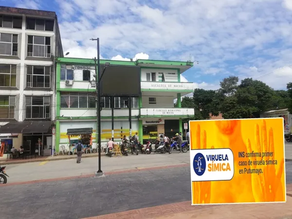 Confirmado: Putumayo reportó el primer caso de viruela del mono