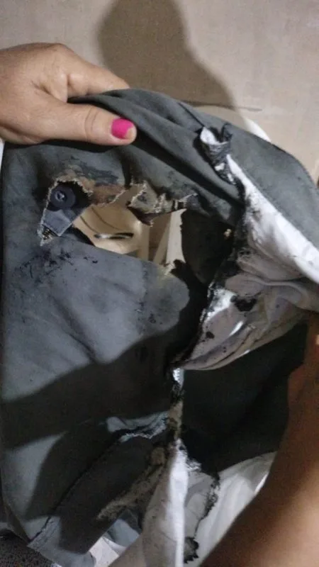 En Neiva a un hombre se le explotó el celular en el bolsillo
