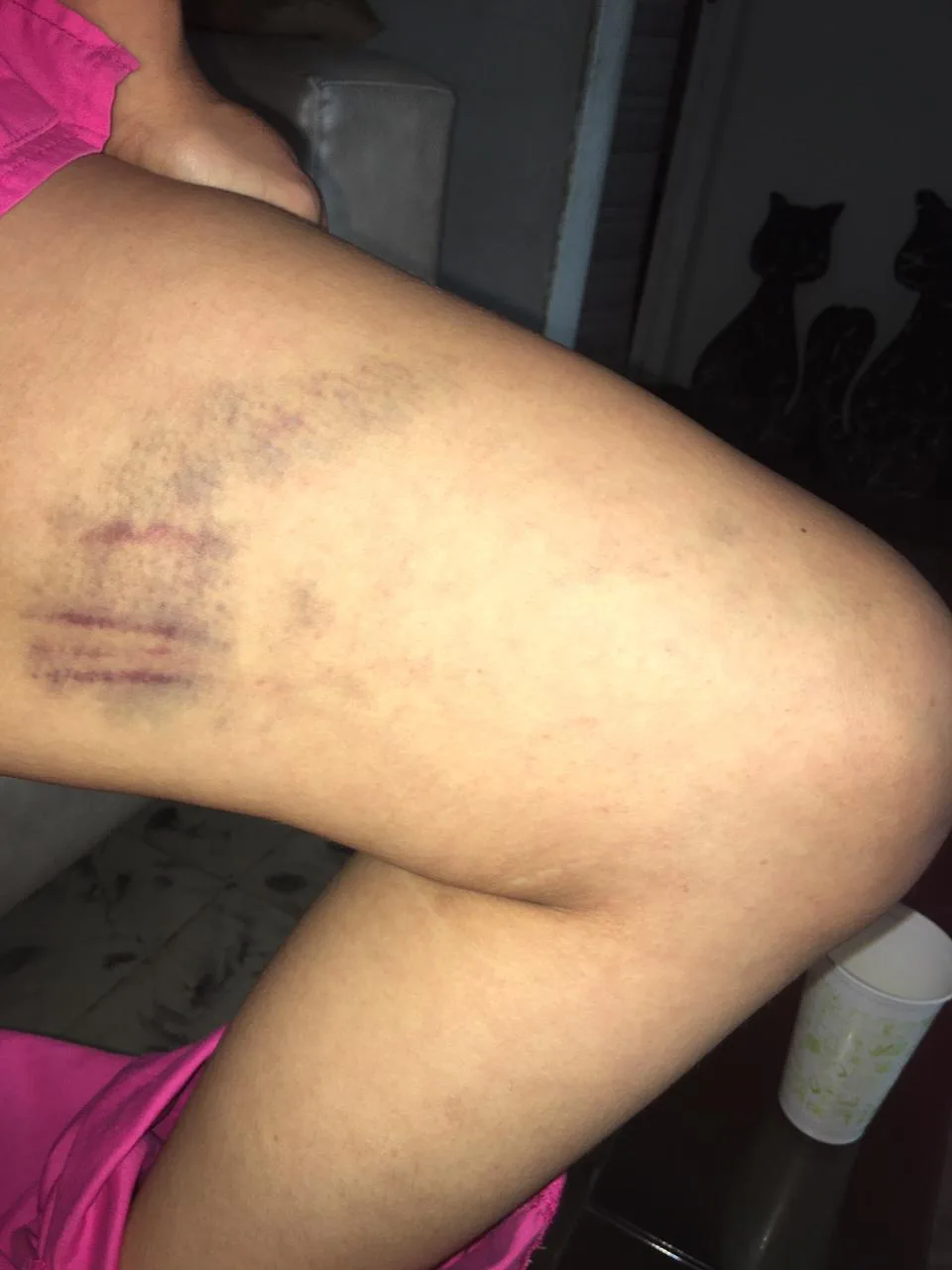 taxista caso San Marcos en Cali