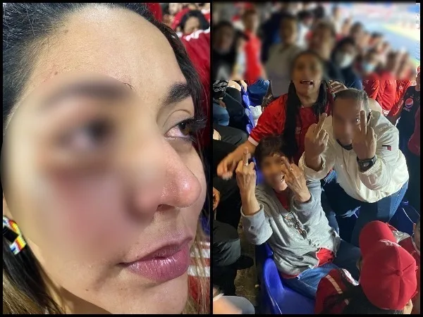 “Que denuncie”, le piden a la mujer que fue golpeada en el Pascual Guerrero, la familia responsable ya estaría identificada