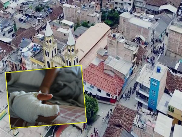 En Nariño sigue aumentando la cifra de quemados, van 13 casos y 7 son niños