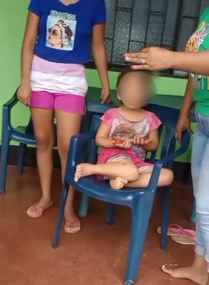 En Arauquita, Arauca, "porque robo una monedas", madre quemó las manos de su hija