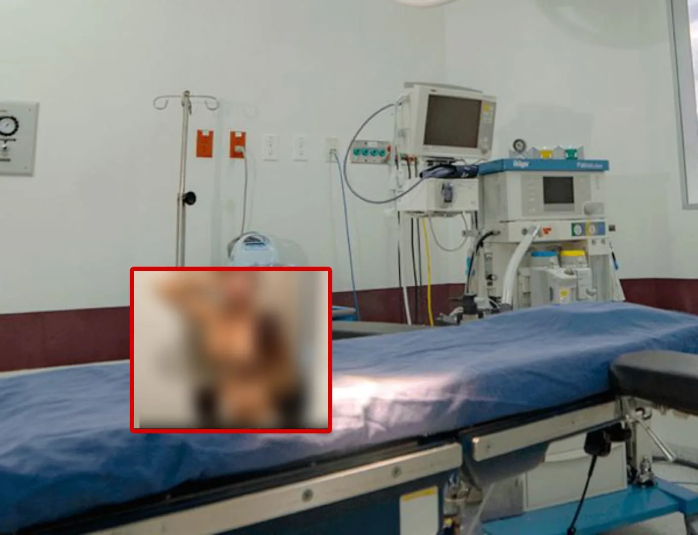 "Le hicieron el daño y la dejaron tirada", denuncian en redes que clínica de estética en Cali hizo una operación y "le daño la vida" a paciente