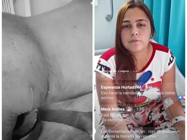 clínica estética de Popayán Monica