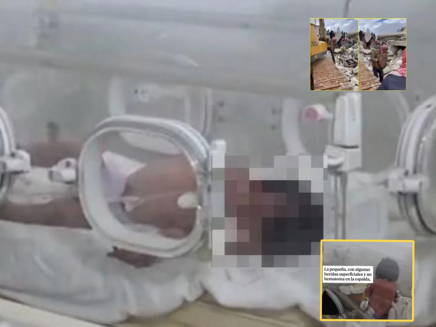 La "bebé milagro" del terremoto, su familia murió pero ella nació entre los escombros en Siria