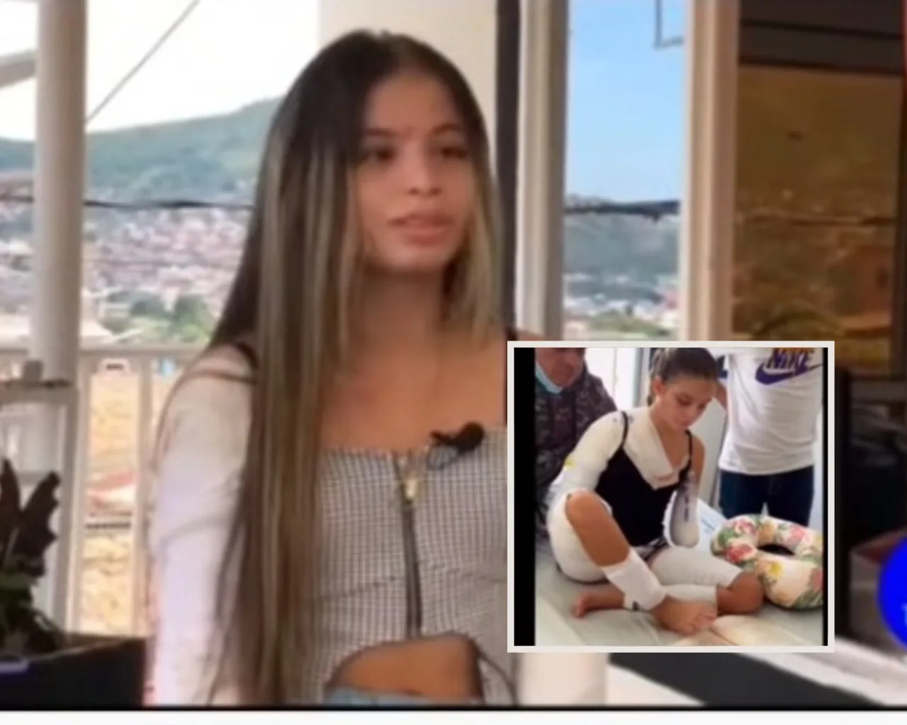 Karen Yumbo prótesis