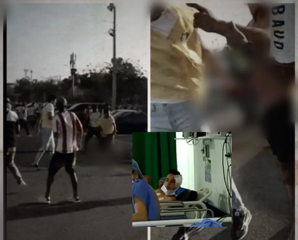 Joymar hincha lo golpearon en Barranquilla