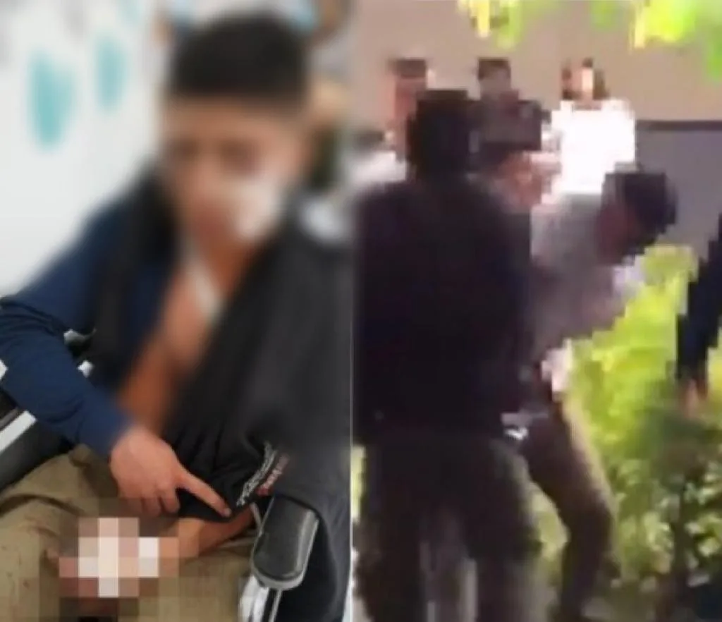 Fuerte riña entre estudiantes en medio del descanso: Uno de 17 hirió con arma blanca a uno de 14 años
