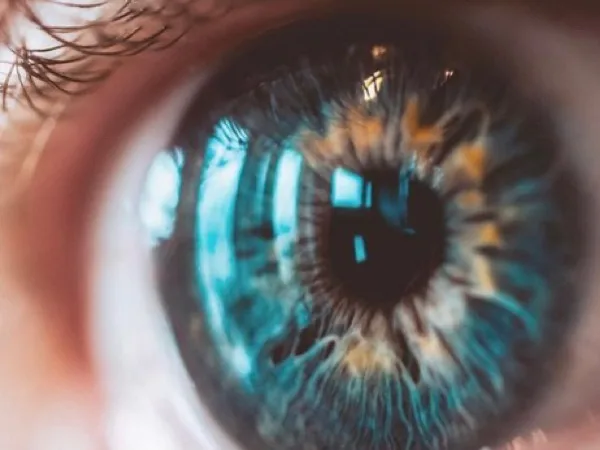 ojos