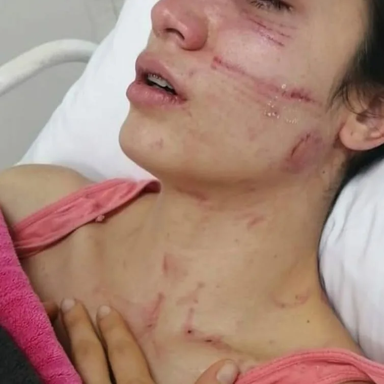 Angélica Circasia, abuso