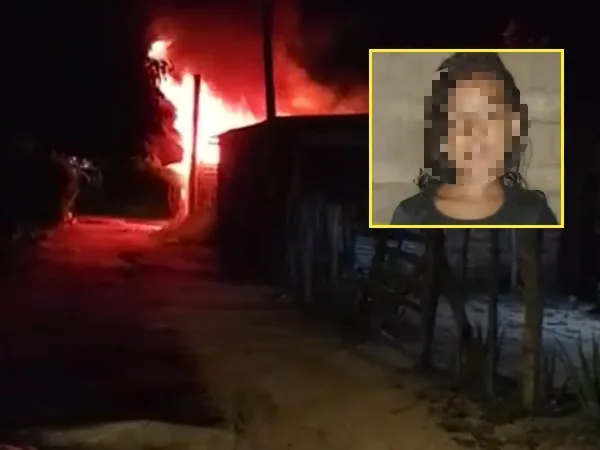 "No resistió por las quemaduras": Murió la niña que tenía el 95% del cuerpo afectado, no había bomberos y demoró la ambulancia